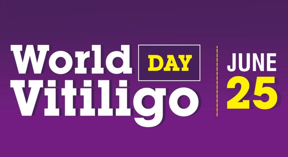 All you need to know about World Vitiligo Day Unite For Vitiligo