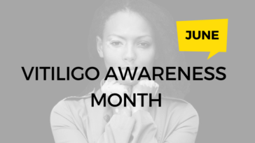 National Vitiligo Awareness Month