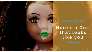 dolls with vitiligo