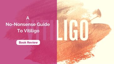 A No-Nonsense Guide To Vitiligo