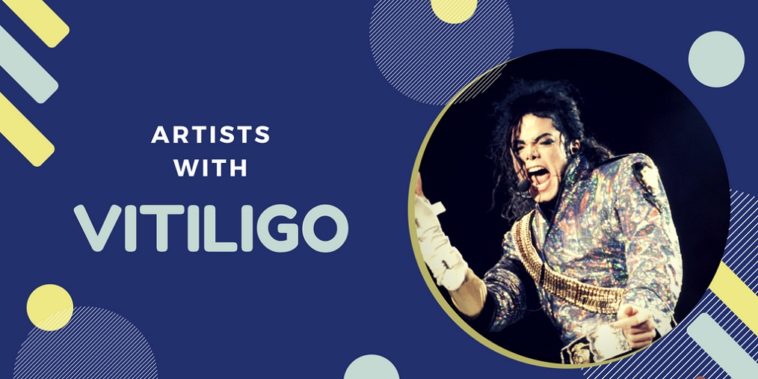 Famous Artists with Vitiligo