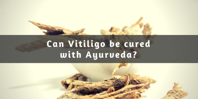 Ayurveda for Vitiligo