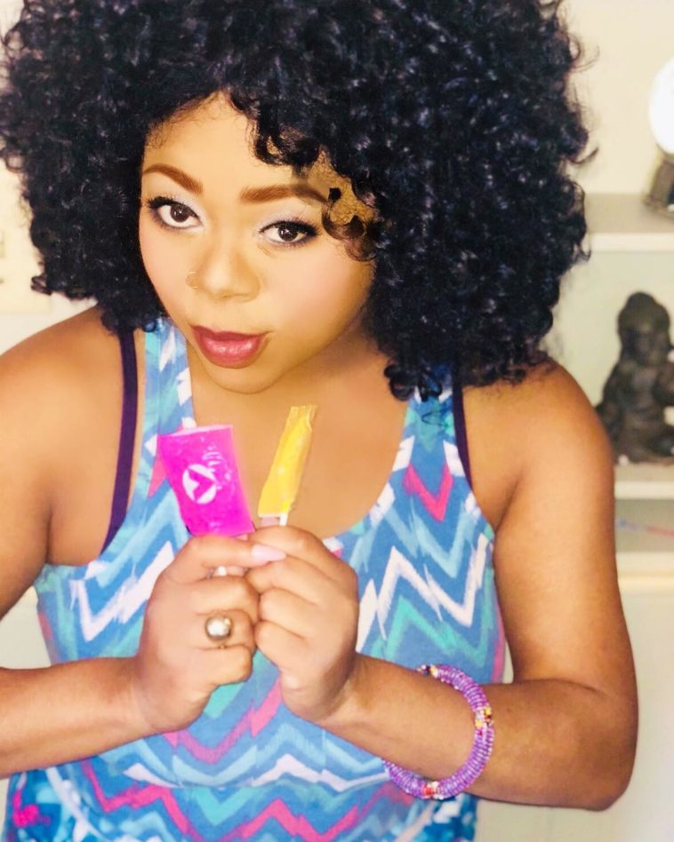 Countess Vaughn vitiligo