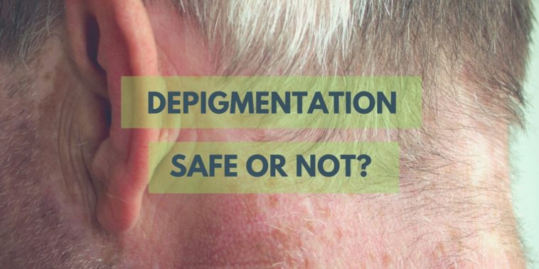 Depigmentation in vitiligo