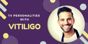 TV Personalities with Vitiligo