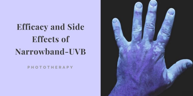 Narrowband UVB phototherapy