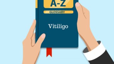 Free Vitiligo Glossary