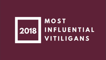 10 Most Influential Vitiligans
