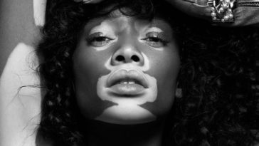Winnie Harlow
