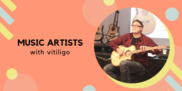 Music Artists with Vitiligo