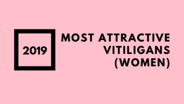 Most Attractive Vitiligans (women)