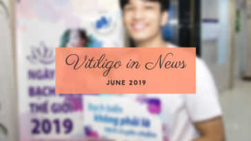 Vitiligo in News during June 2019
