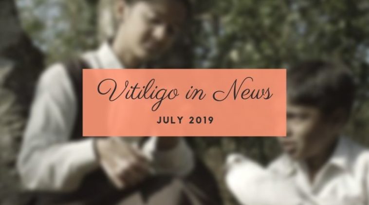 Vitiligo News July 2019