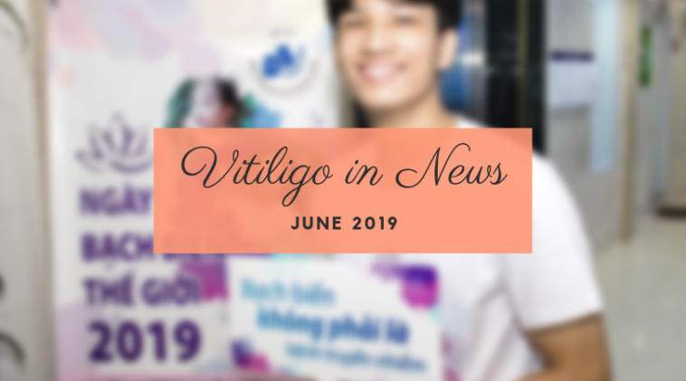 Vitiligo in News during June 2019