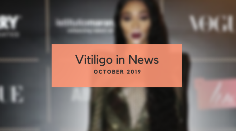 Vitiligo News - October 2019