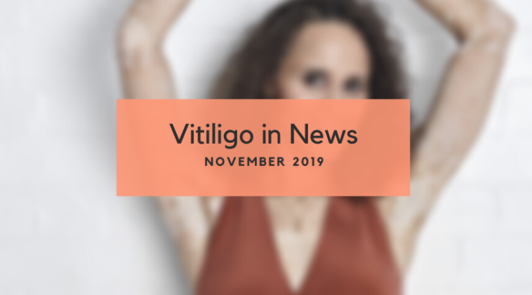 Vitiligo News November 2019