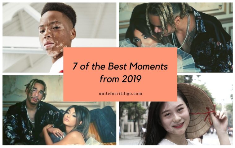 2019 vitiligo moments