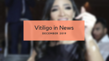 Vitiligo News December 2019
