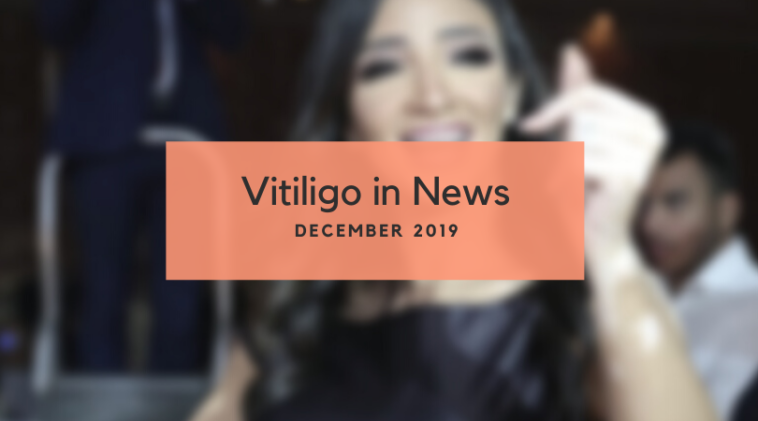 Vitiligo News December 2019