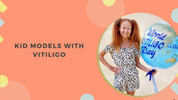 Kid Models with Vitiligo 
