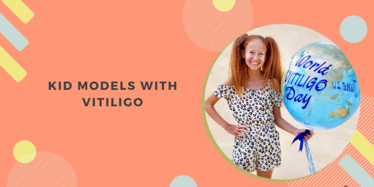 Kid Models with Vitiligo 