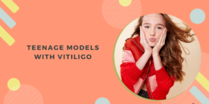 Teenage Models with Vitiligo