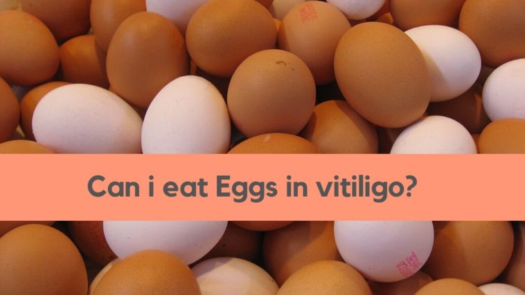 eggs vitiligo