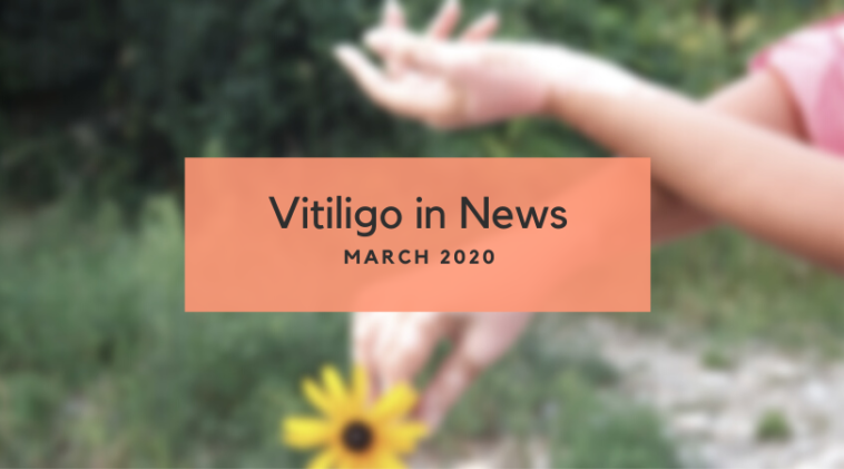 Vitiligo News March 2020