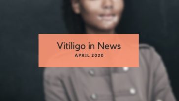 Vitiligo News Apri 2020