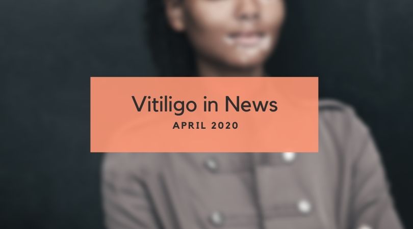 Vitiligo in News April 2020 Unite For Vitiligo