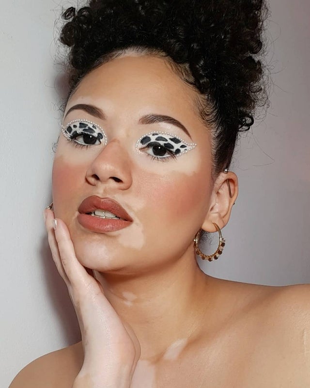 vitiligo eye makeup