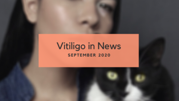 Vitiligo News - September 2020