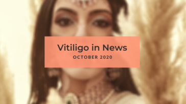 Vitiligo News October 2020