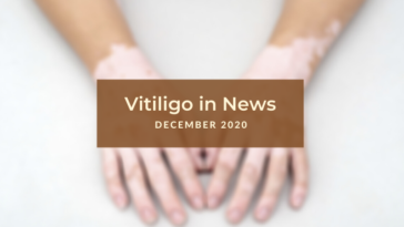 Vitiligo News December 2020