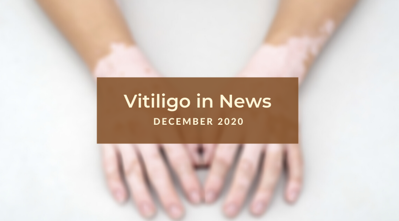 Vitiligo in News December 2020 Unite For Vitiligo