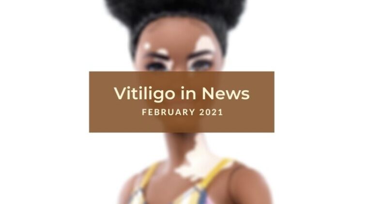 February 2021 Vitiligo News