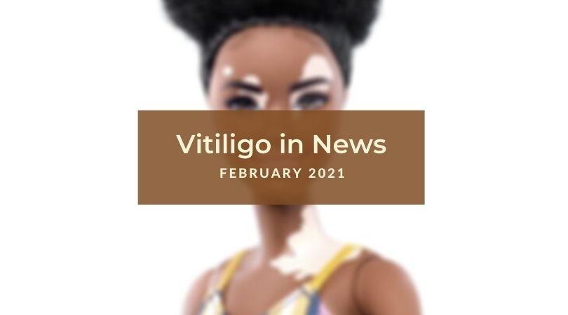 Vitiligo in News February 2021 Unite For Vitiligo