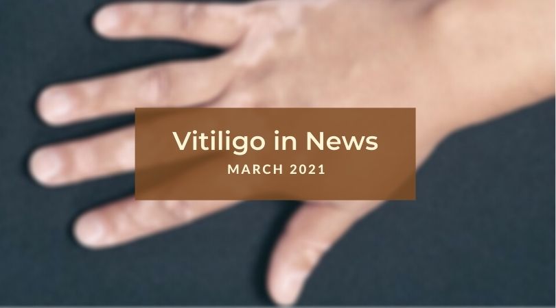 Vitiligo in News March 2021 Unite For Vitiligo