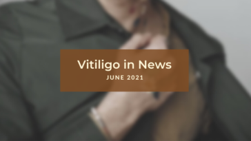 Vitiligo News June 2020