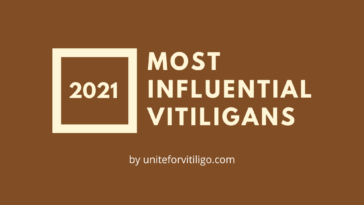 Influencers with Vitiligo