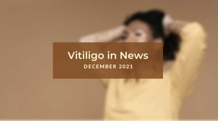 Vitiligo News - December 2021