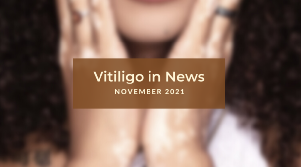 Vitiligo News November 2021