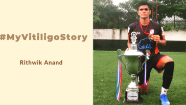 My Vutiligo Story - Rithwik Anand