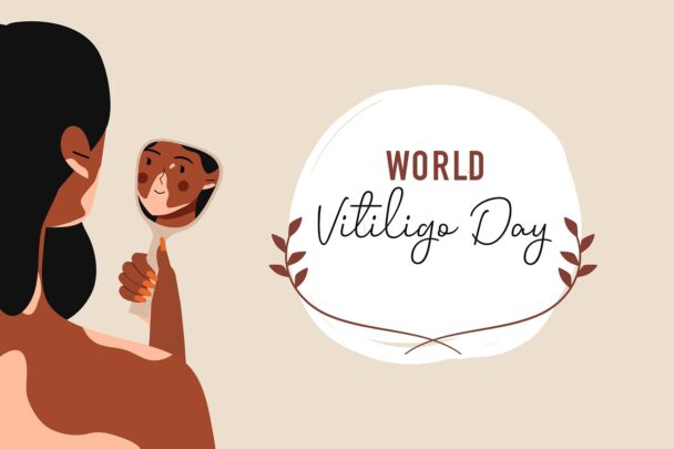 World Vitiligo Day 2022