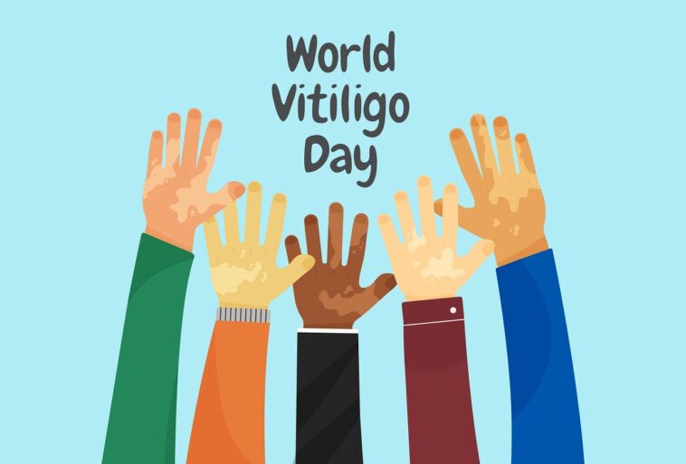 world vitiligo day 2022